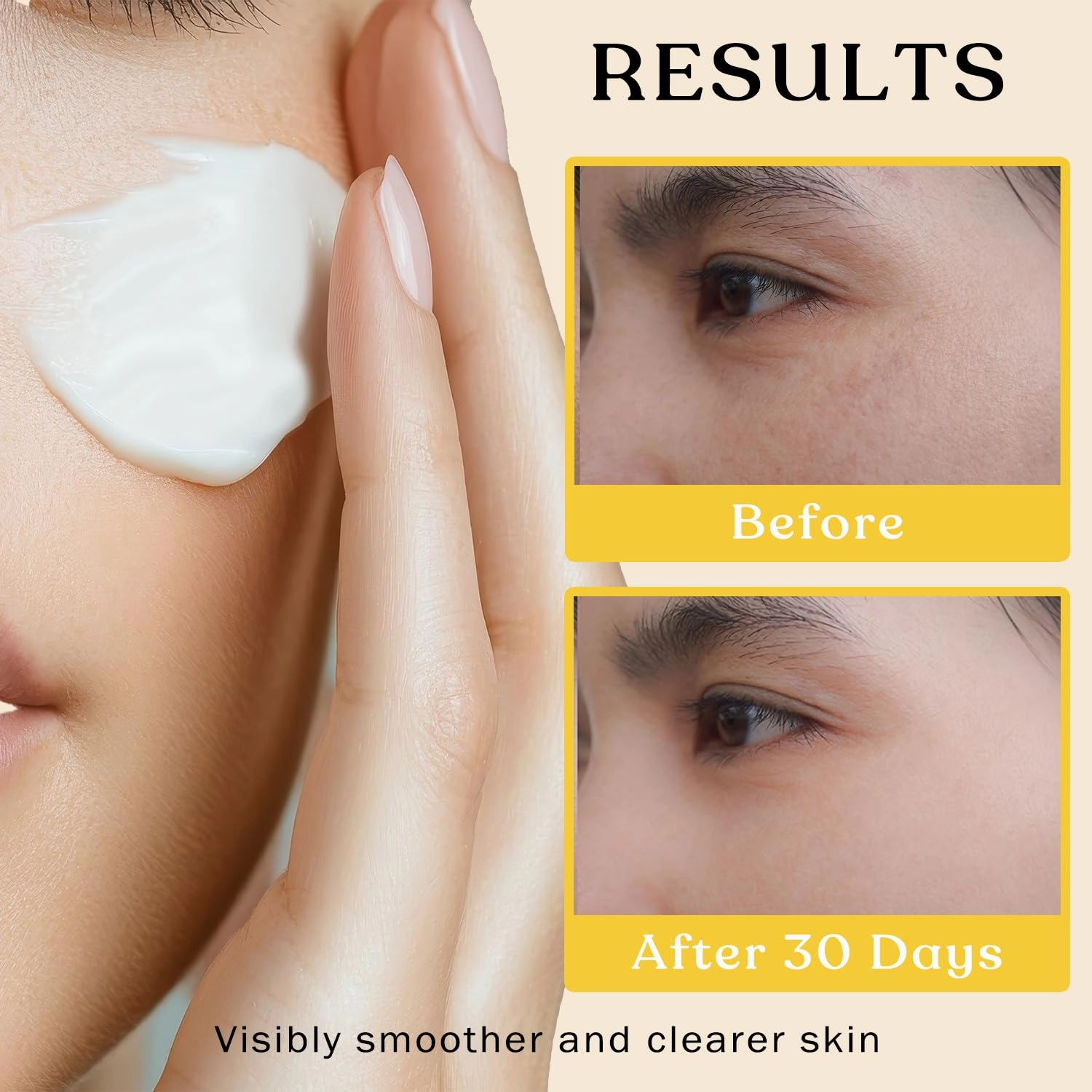 Beef Tallow Sun Balm for Skin - Moisturizer Cream - 100% Grass Fed Whipped Beef Tallow - Herb Infused - Supports Eczema, Rosacea - Made in USA - Unscented - 2 oz