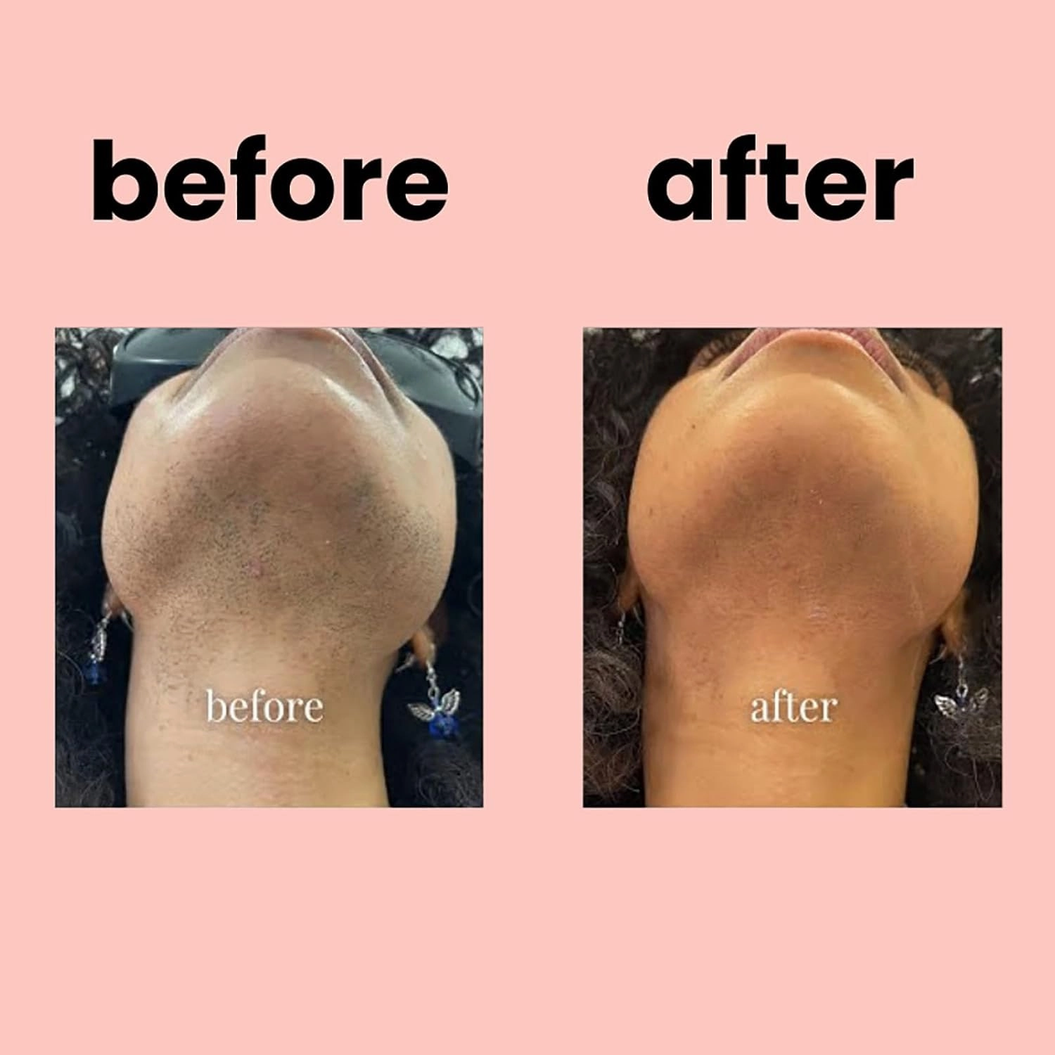 Hair Removal Cream Kit, Facial Hair Removal Cream Kit, Facial Hair Removal, Nicor ​​lip Hair Removal Cream,1.4 Oz Hair Removal Women Oil Control and Moisturizing (3)